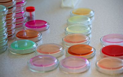 Especial de Salmonella